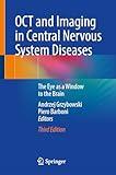 OCT and Imaging in Central Nervous System Diseases: The Eye as a Window to the Brain