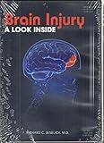 Brain Injury: A Look Inside