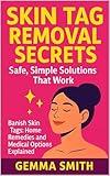 Skin Tag Removal Secrets: Safe, Simple Solutions That Work | The Skin Tag Solution: How to Remove Skin Tags Naturally & Effectively: Banish Skin Tags: Home Remedies and Medical Options Explained