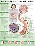 Understanding Type 2 Diabetes Anatomical Chart